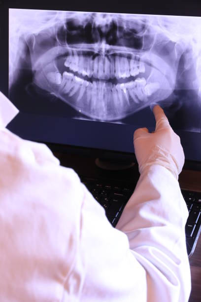 Best Broken or Chipped Tooth Repair in Palm Beach Gardens, FL